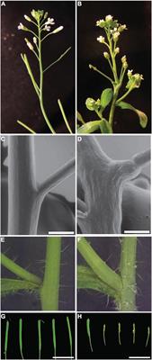 BUMPY STEM Is an Arabidopsis Choline/Ethanolamine Kinase Required for Normal Development and Chilling Responses